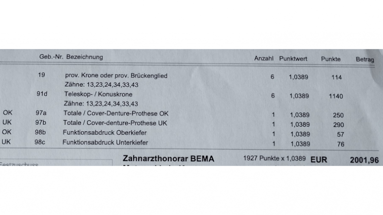 BEMA 100b (i): Wiederherstellung abnehmbarer Prothesen