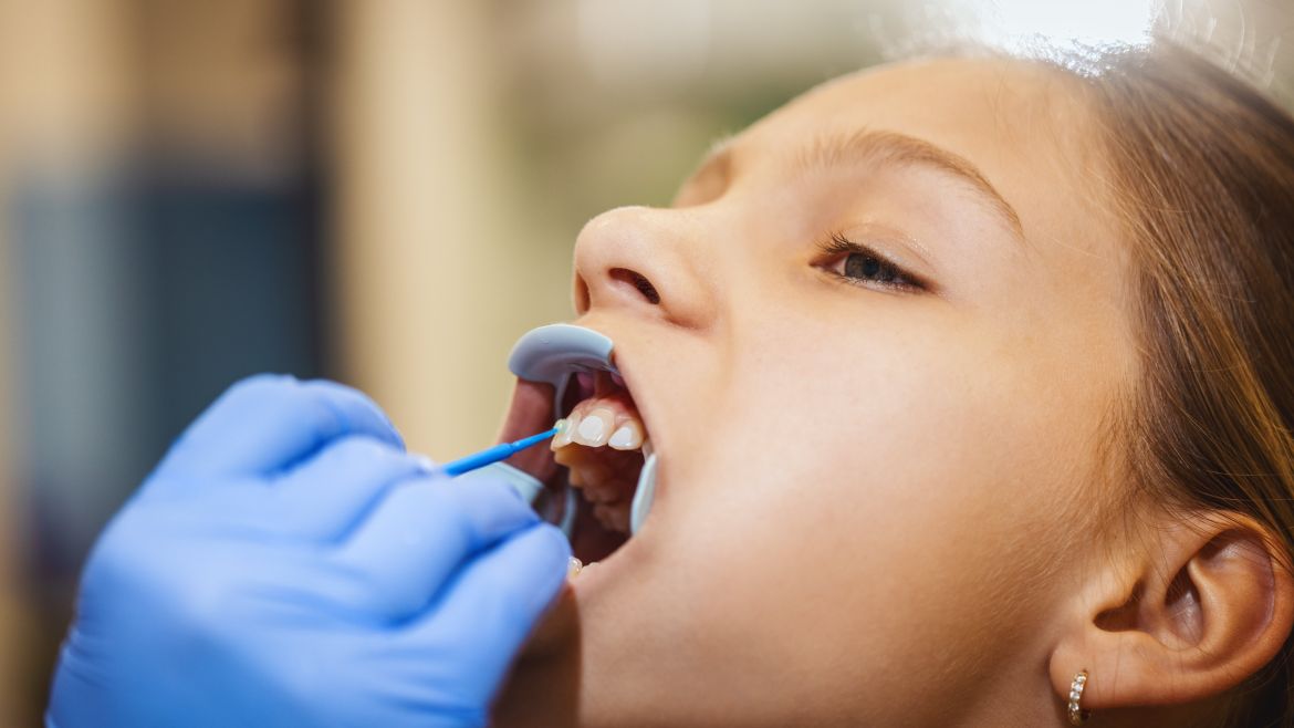 Eine Korrektur des Lippenbändchens ist in wenigen Minuten möglich.