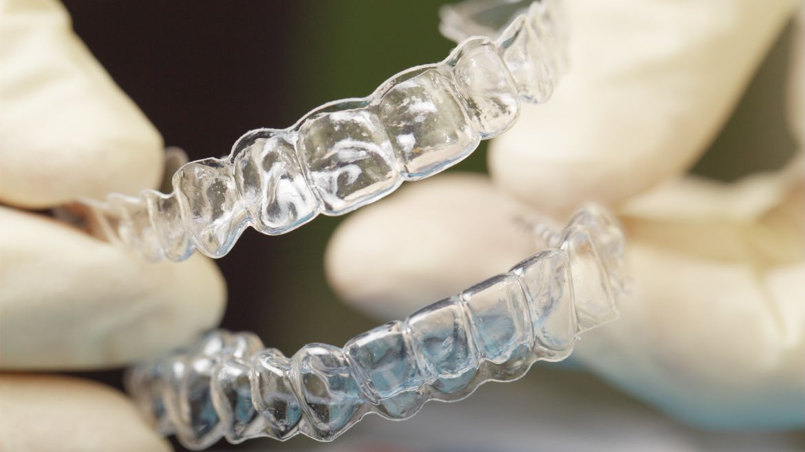 Moderne Zahnschienen sind transparent gestaltet.