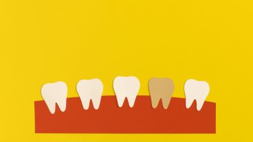 Symbolische Darstellung einer Zahnreihe vor gelbem Hintergrund